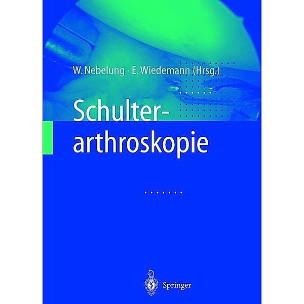 Schulterarthroskopie