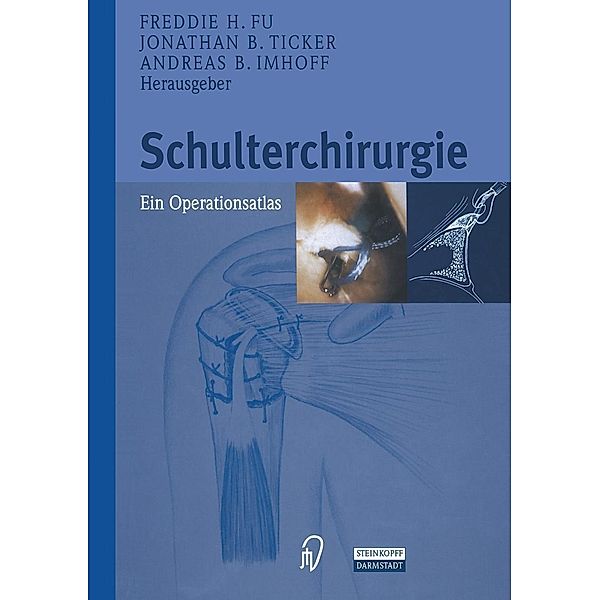 Schulterchirurgie