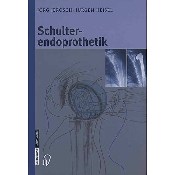 Schulterendoprothetik, Jörg Jerosch, Jürgen Heisel