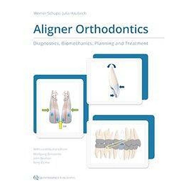 Schupp, W: Aligner Orthodontics, Werner Schupp, Julia Haubrich