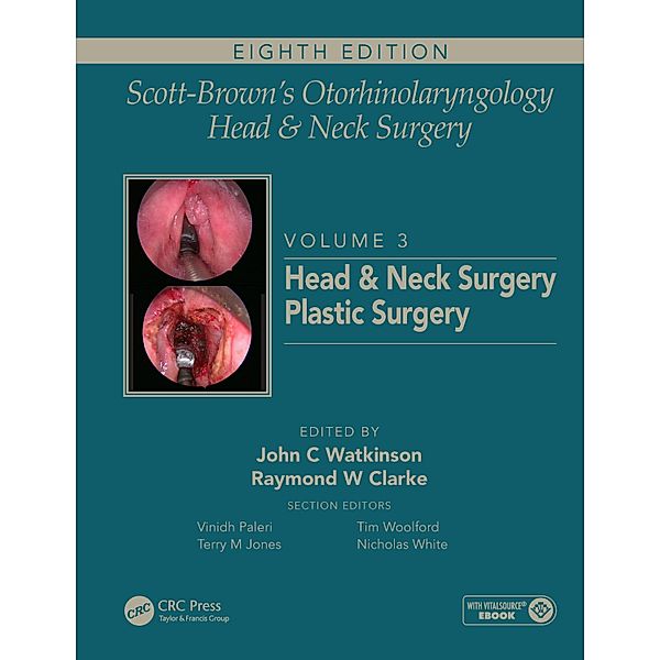 Scott-Brown's Otorhinolaryngology and Head and Neck Surgery