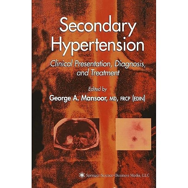 Secondary Hypertension / Clinical Hypertension and Vascular Diseases, George A. Mansoor