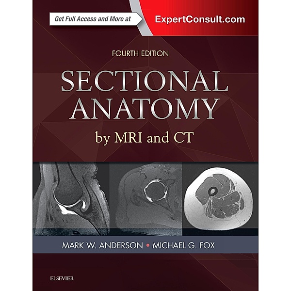 Sectional Anatomy by MRI and CT, Mark W. Anderson, Michael G Fox