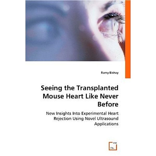 Seeing the Transplanted Mouse Heart Like Never Before, Ramy Bishay