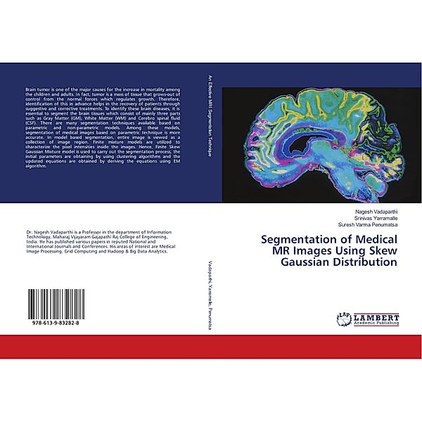 Segmentation of Medical MR Images Using Skew Gaussian Distribution, Nagesh Vadaparthi, Srinivas Yarramalle, Suresh Varma Penumatsa