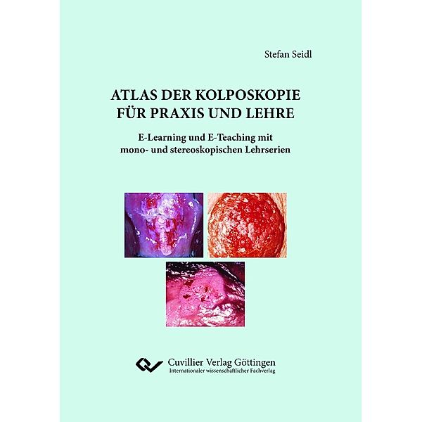 Seidl, S: Atlas der Kolposkopie für Praxis und Lehre, Stefan Seidl