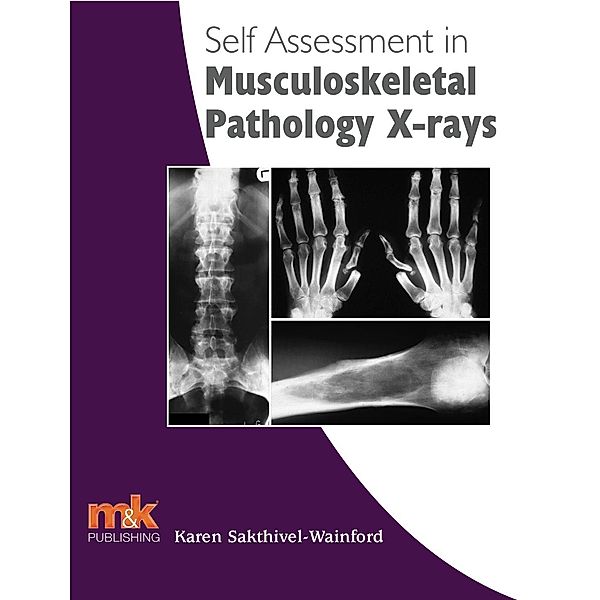 Self Assessment in Musculoskeletal Pathology X-rays, Karen Sakthivel Wainford