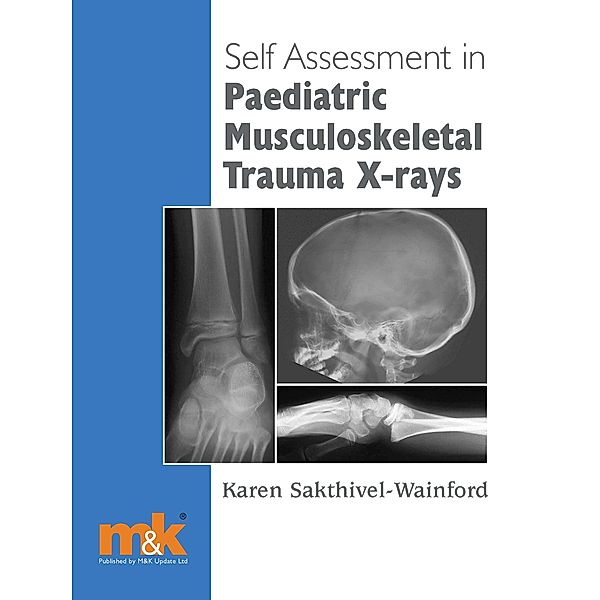 Self-assessment in Paediatric Musculoskeletal Trauma X-rays / Self-assessment X-ray Interpretation, Karen Sakthivel-Wainford