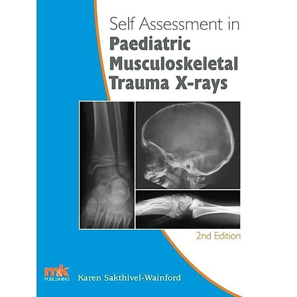 Self-assessment in Paediatric Musculoskeletal Trauma X-rays, Karen Sakthivel-Wainford