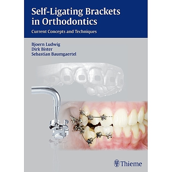 Self-ligating Brackets in Orthodontics, Björn Ludwig, Dirk Bister, Sebastian Baumgaertel