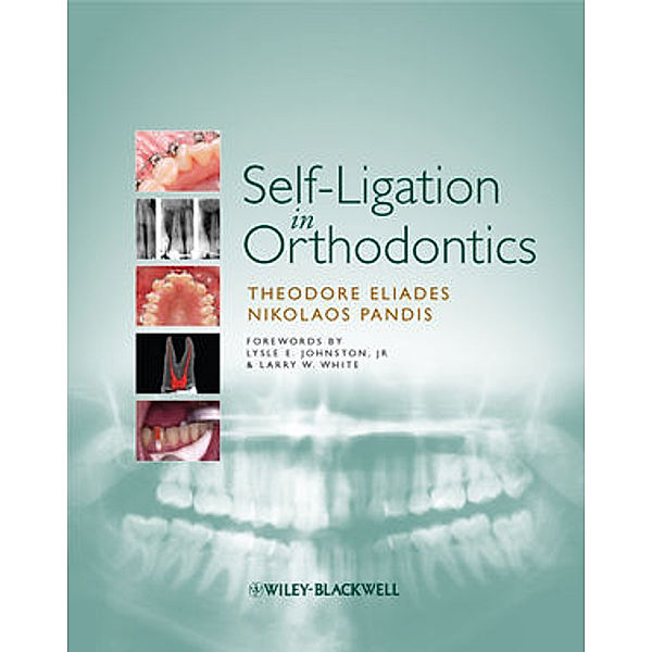 Self-Ligation in Orthodontics, Theodore Eliades, Nikolaos Pandis