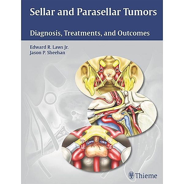 Sellar and Parasellar Tumors