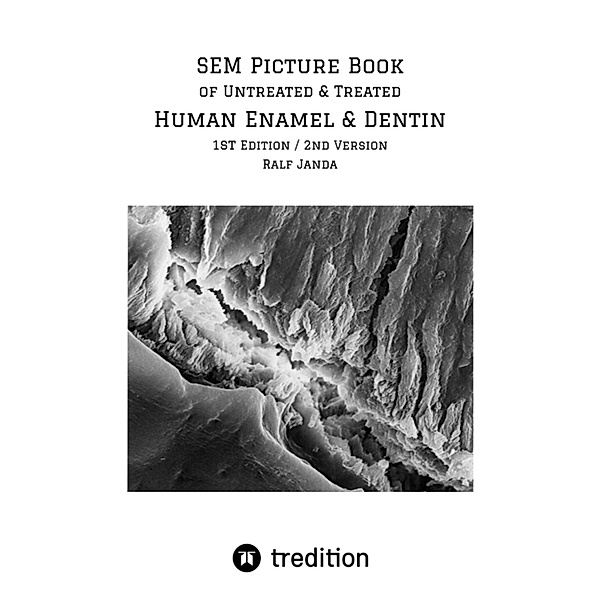 SEM Picture Book of Untreated & Treated Human Enamel & Dentin, Ralf Janda