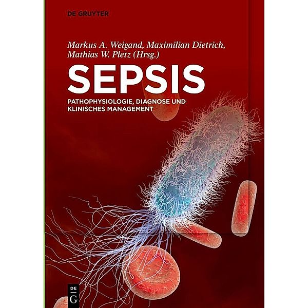 Sepsis