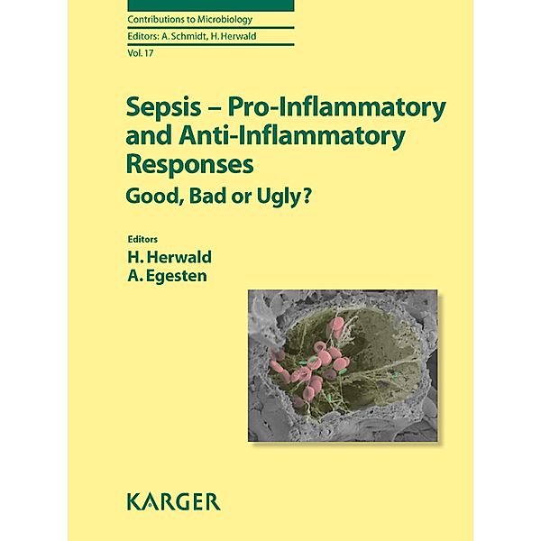 Sepsis - Pro-Inflammatory and Anti-Inflammatory Responses