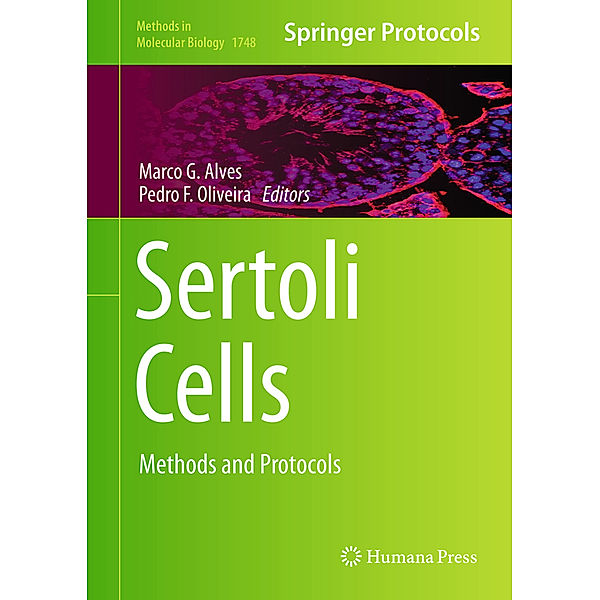 Sertoli Cells