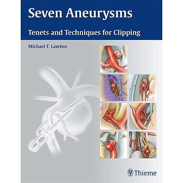 Seven Aneurysms