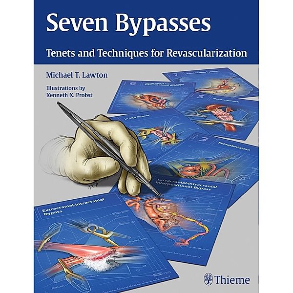 Seven Bypasses, Michael T. Lawton