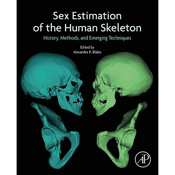 Sex Estimation of the Human Skeleton