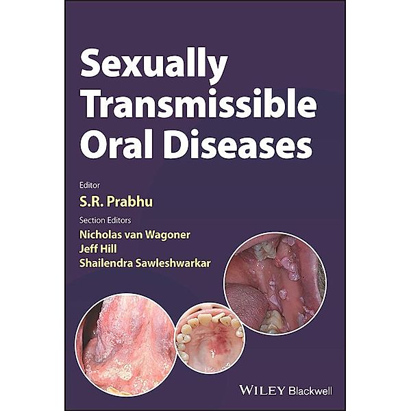 Sexually Transmissible Oral Diseases