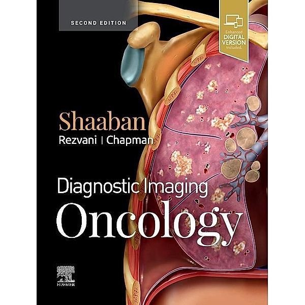 Shaaban, A: Diagnostic Imaging: Oncology, Akram M. Shaaban, Maryam Rezvani, Philip R. Chapman