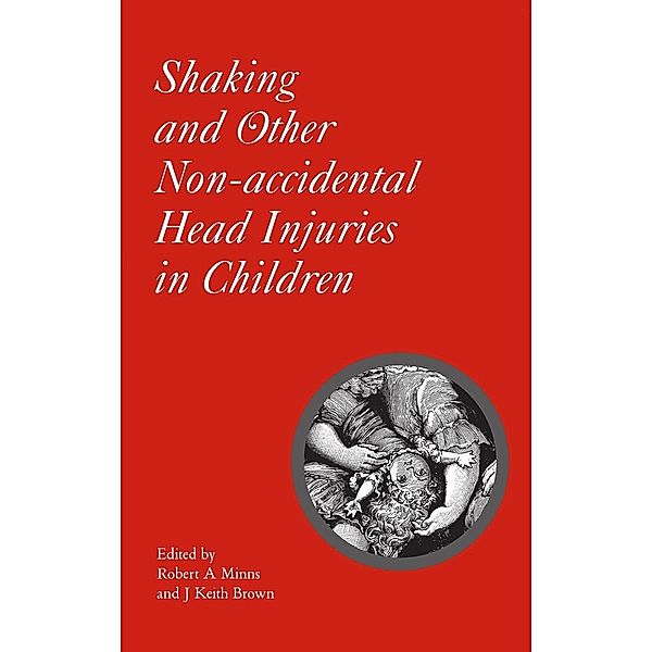Shaken Baby Syndrome and Other Non-Accidental Head Injuries in Children
