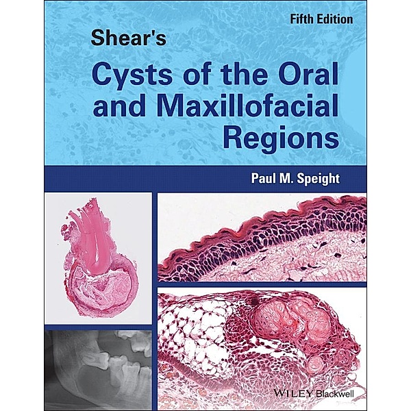 Shear's Cysts of the Oral and Maxillofacial Regions, Paul M. Speight