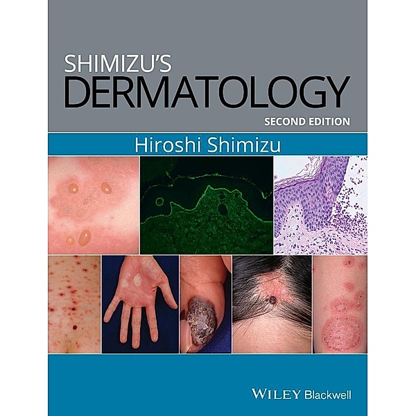 Shimizu's Dermatology, Hiroshi Shimizu