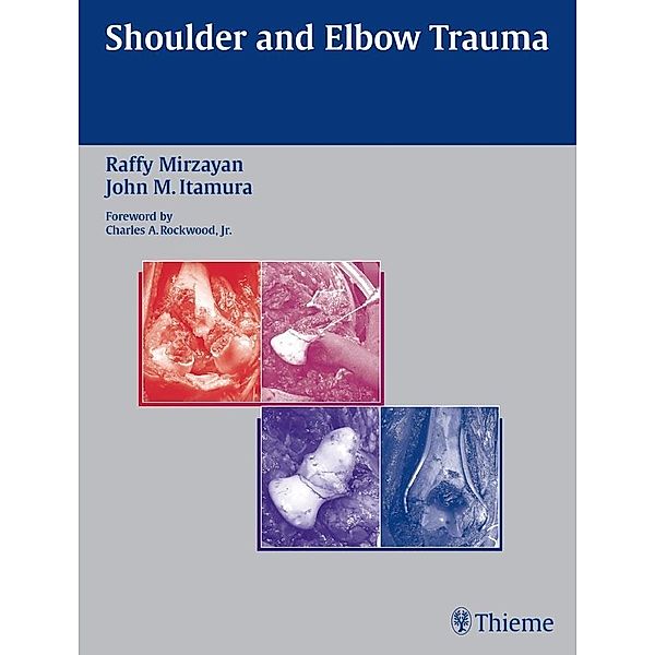 Shoulder and Elbow Trauma