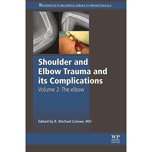 Shoulder and Elbow Trauma and its Complications, Michael Greiwe