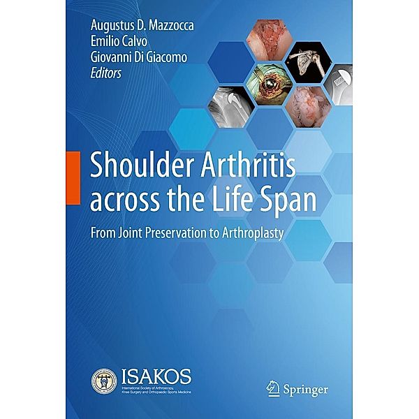 Shoulder Arthritis across the Life Span