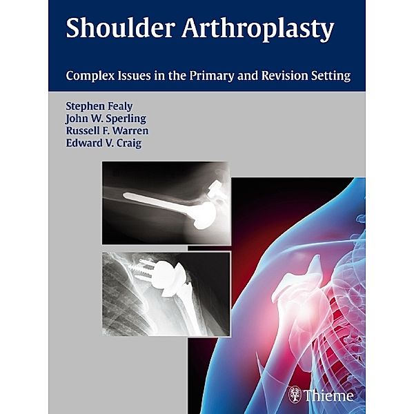 Shoulder Arthroplasty, Stephen Fealy, John W. Sperling, Russell F. Warren, Edward V. Craig