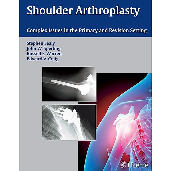 Shoulder Arthroplasty