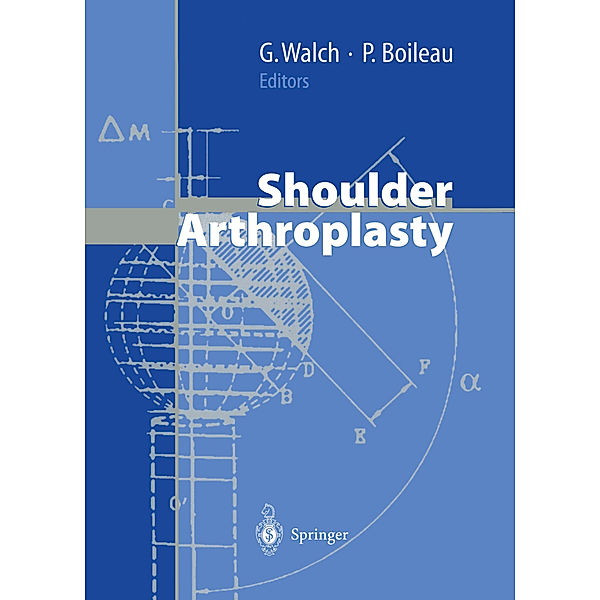 Shoulder Arthroplasty