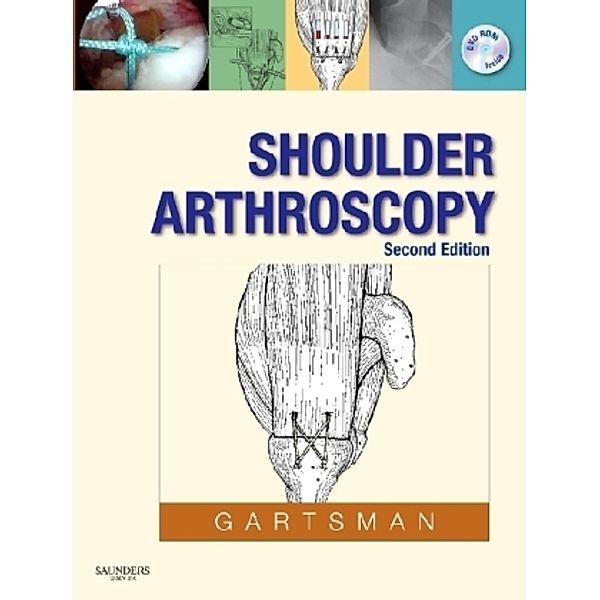 Shoulder Arthroscopy, Gary Gartsman