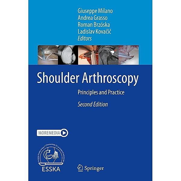 Shoulder Arthroscopy