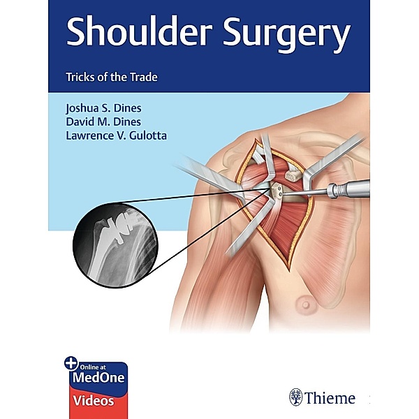 Shoulder Surgery, Joshua Dines, David M. Dines, Lawrence V. Gulotta