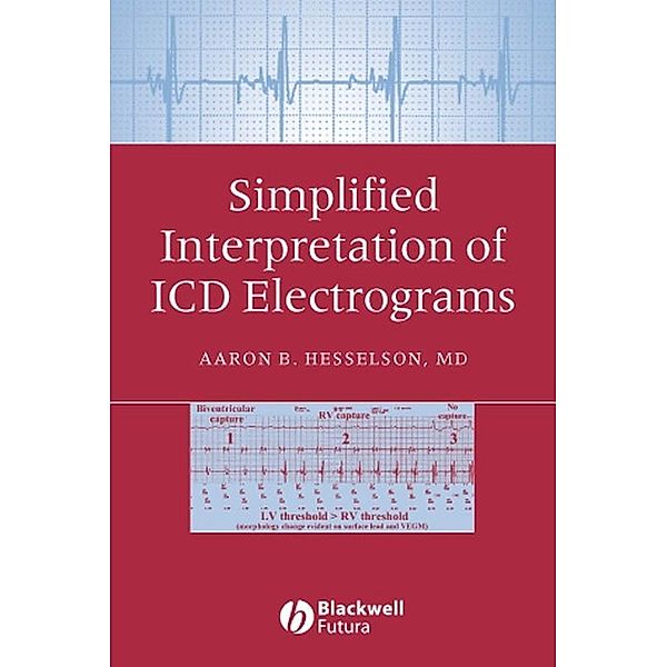 Simplified Interpretation of ICD Electrograms, Aaron B. Hesselson