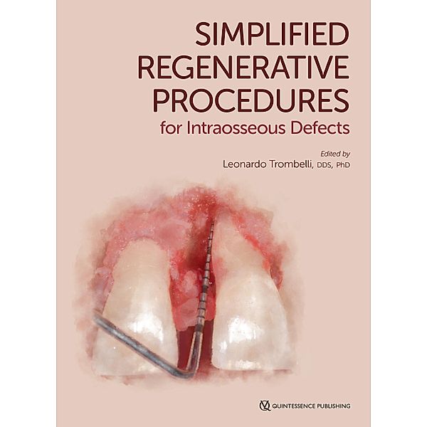 Simplified Regenerative Procedures for Intraosseous Defects, Leonardo Trombelli