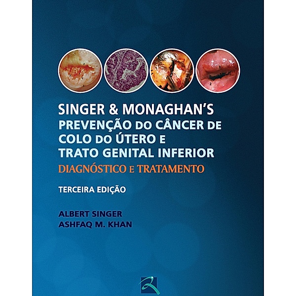 Singer & Monaghan's: prevenção do câncer de colo do útero e trato genital inferior, Albert Singer, Ashfaq M. Khan