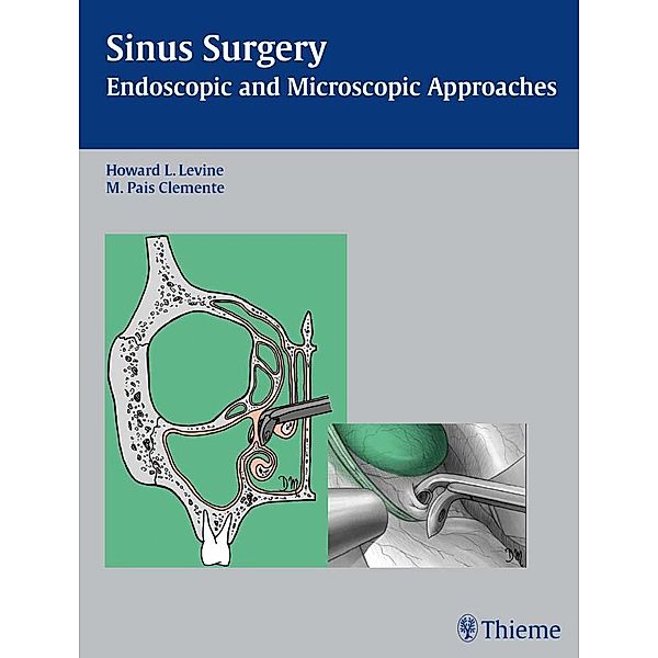 Sinus Surgery