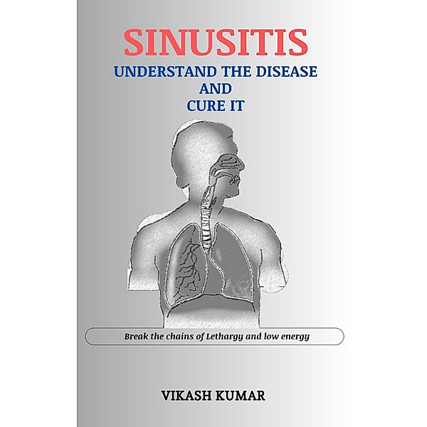 Sinusitis : Understand the disease and cure it, Vikash Kumar