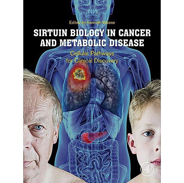 Sirtuin Biology in Cancer and Metabolic Disease