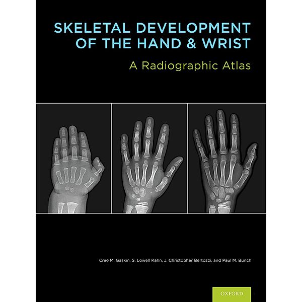 Skeletal Development of the Hand and Wrist, Cree M. Gaskin, S. Lowell Kahn, J. Christoper Bertozzi, Paul M. Bunch