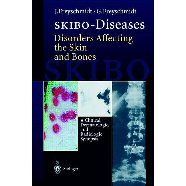 SKIBO-Diseases Disorders Affecting the Skin and Bones, Jürgen Freyschmidt, Gisela Freyschmidt