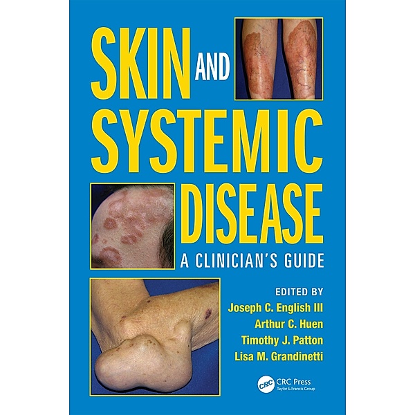 Skin and Systemic Disease, Joseph C. English III, Arthur C. Huen, Timothy J. Patton, Lisa M. Grandinetti