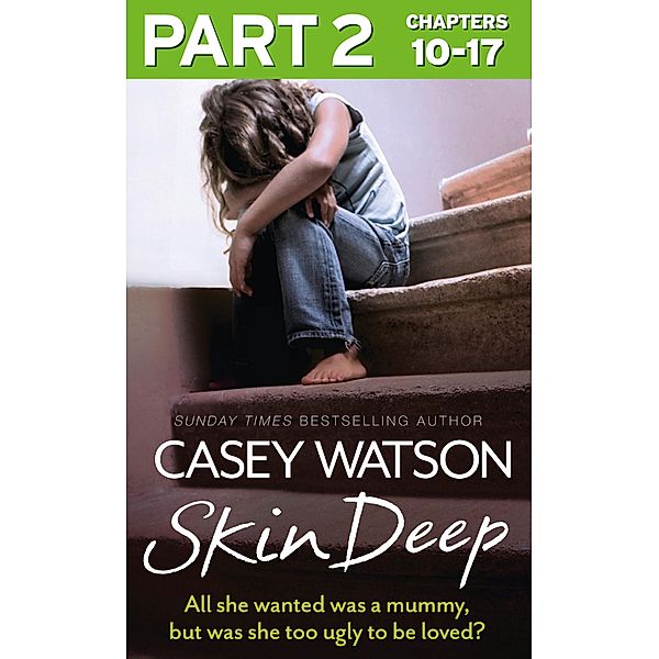 Skin Deep: Part 2 of 3, Casey Watson