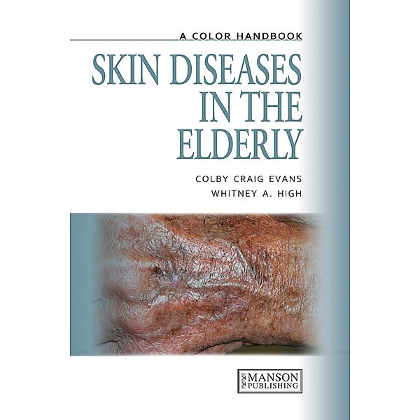 Skin Diseases in the Elderly, Colby Evans, Whitney High