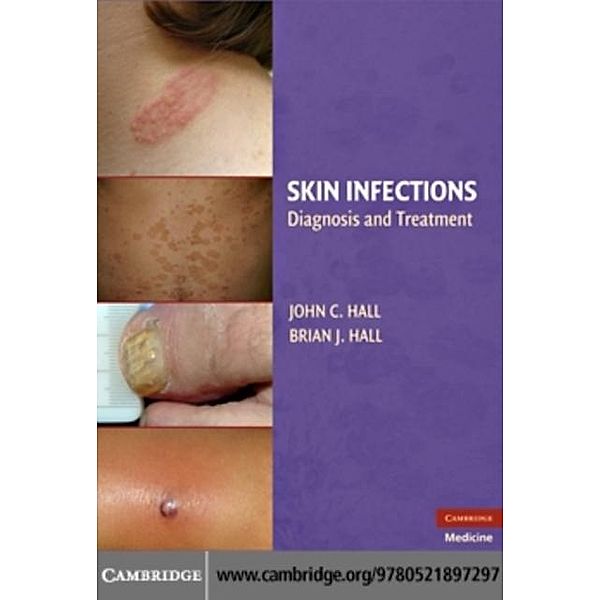 Skin Infections, Brian J. Hall
