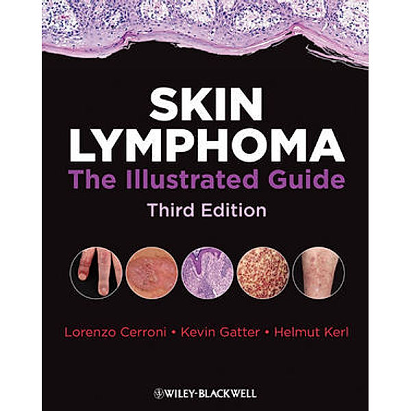 Skin Lymphoma, Lorenzo Cerroni, Kevin Gatter, Helmut Kerl